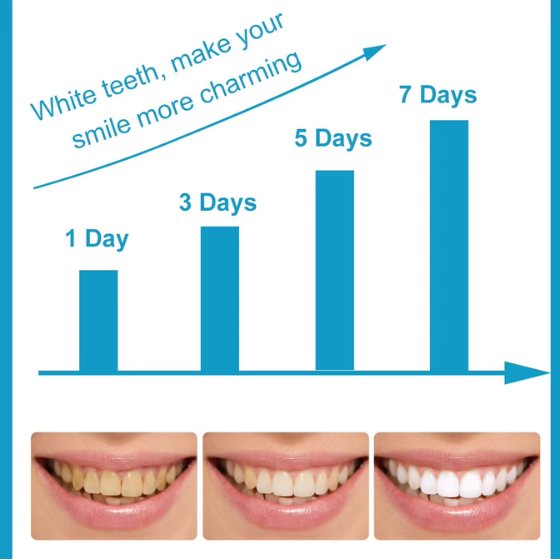 Smile Power White Teeth Whitening