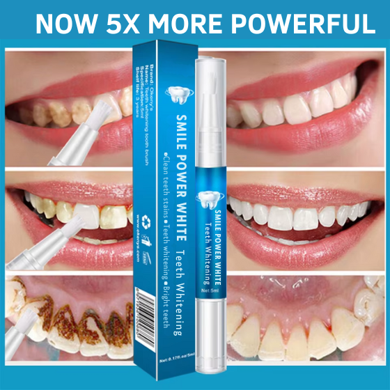 Smile Power White Teeth Whitening