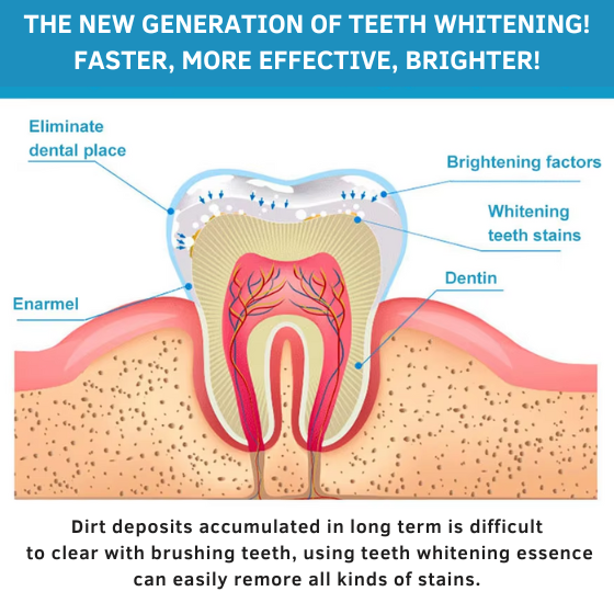 Smile Power White Teeth Whitening