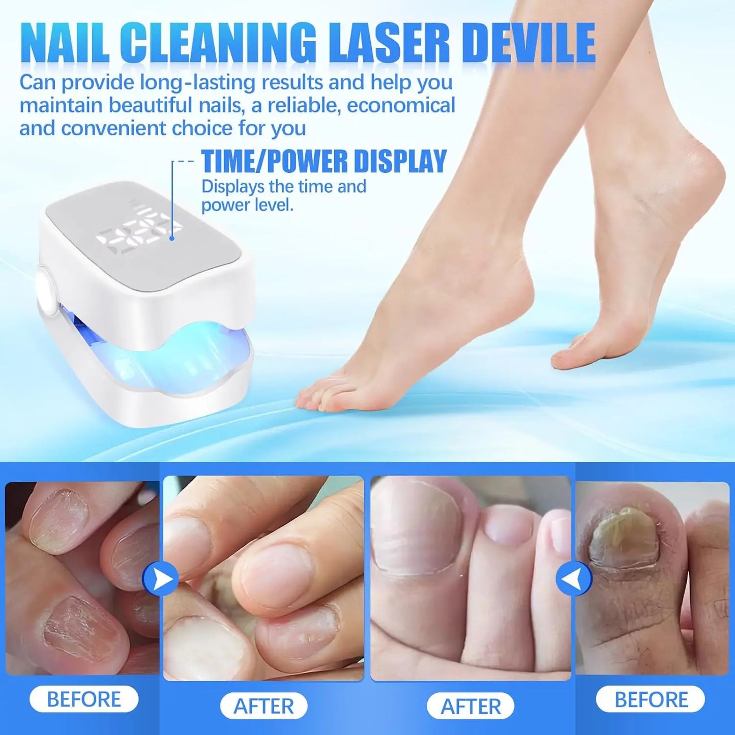 LumiCure Nail - Advanced LED Fungal Solution